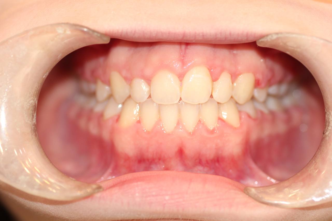 После лечения