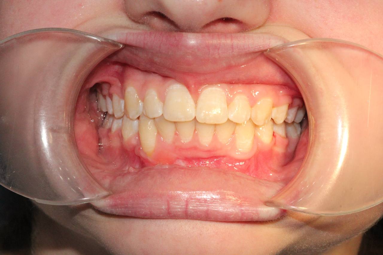 После лечения