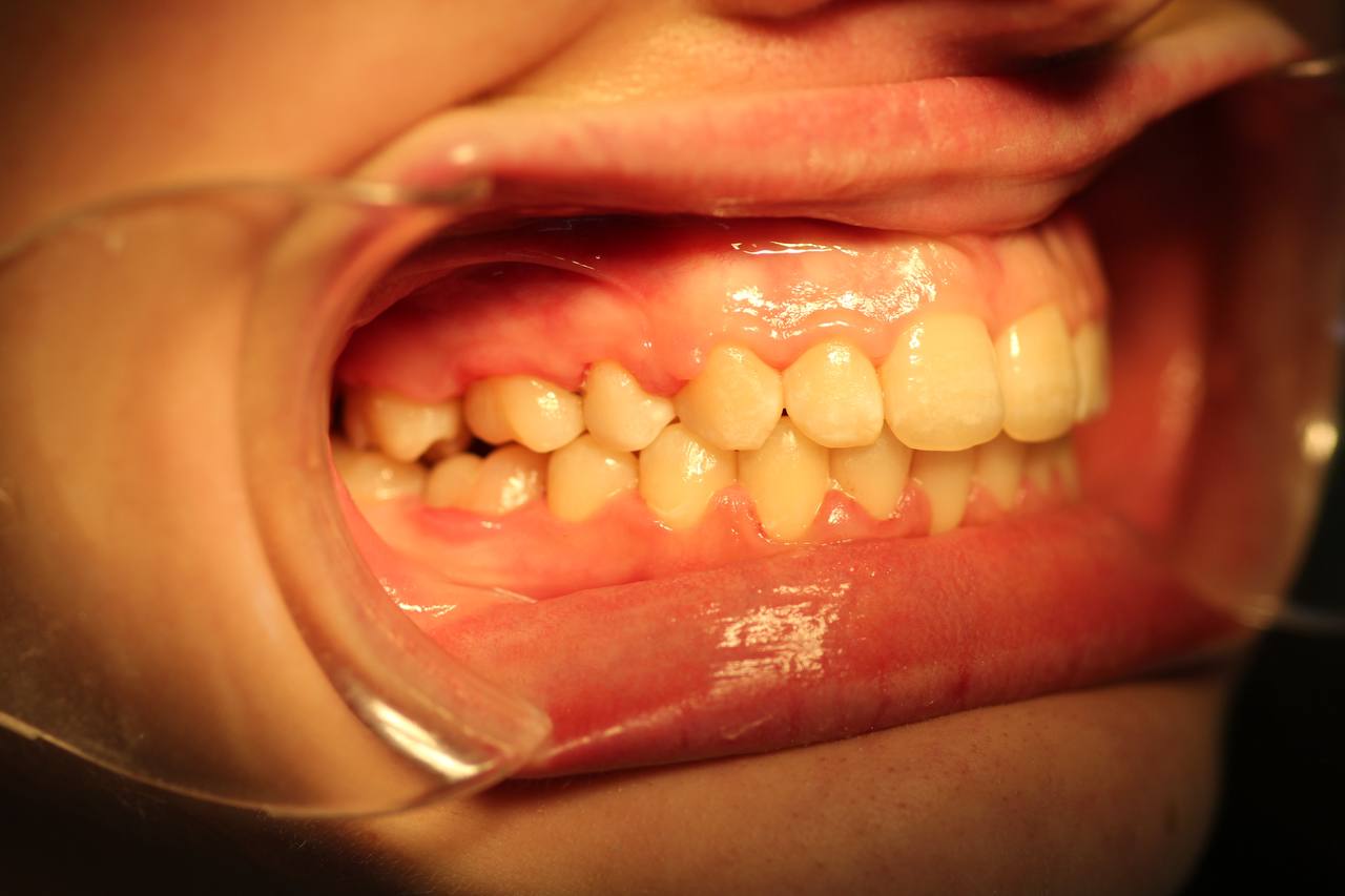 После лечения